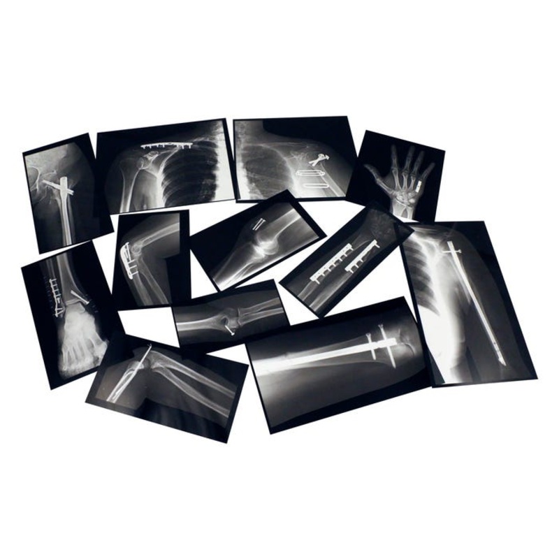 Roylco Fixed Bones X-rays